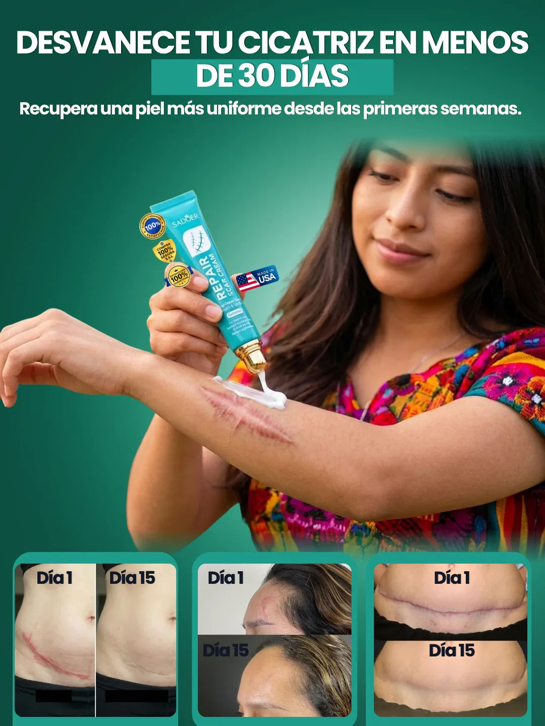 REPAIR SCAR CREAM | Crema para cicatriz