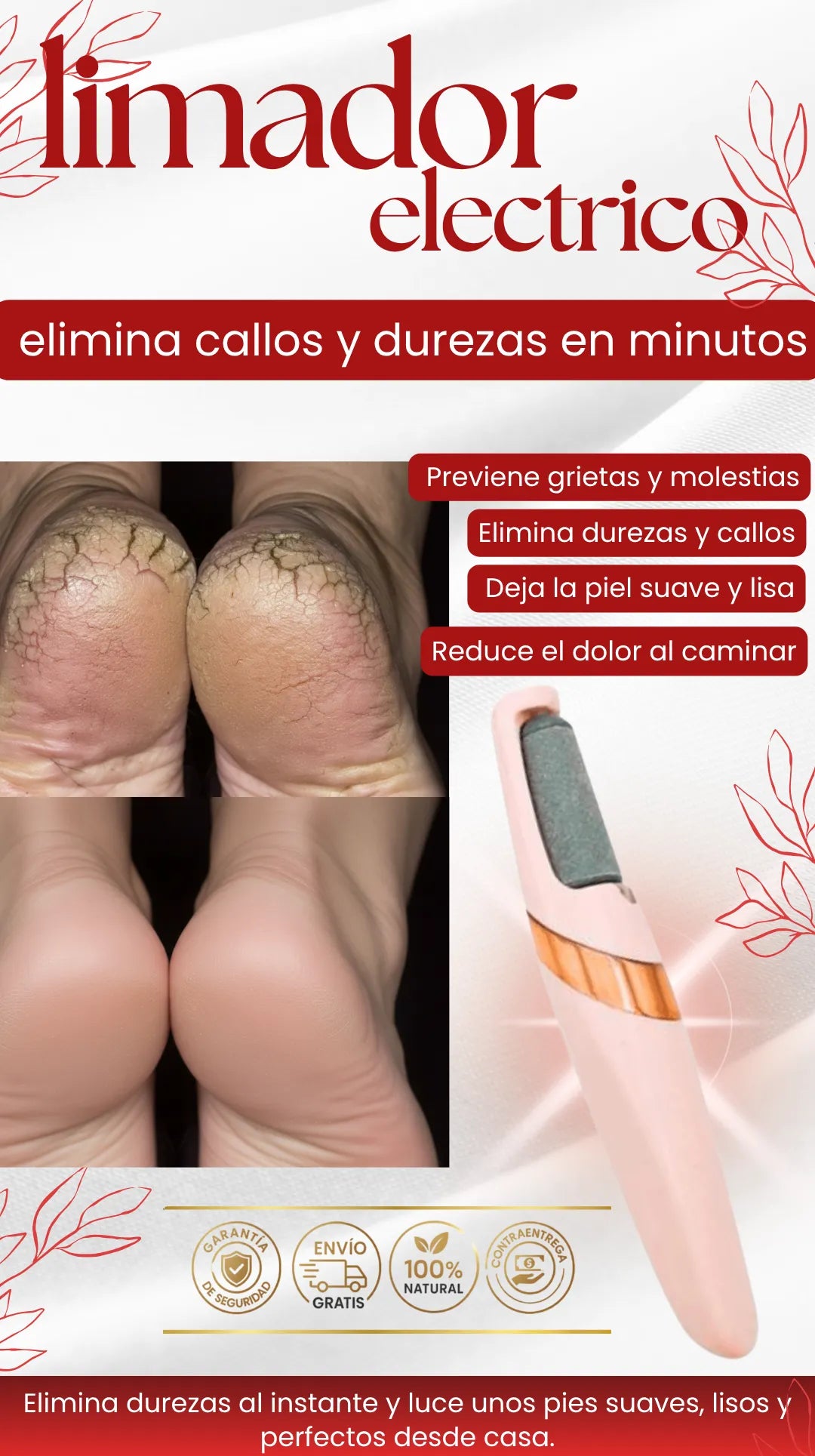 Limador de callos | Elimina callos y luce pies suaves