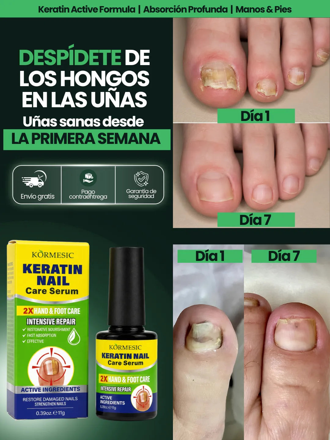 Removedor Americano de Hongos