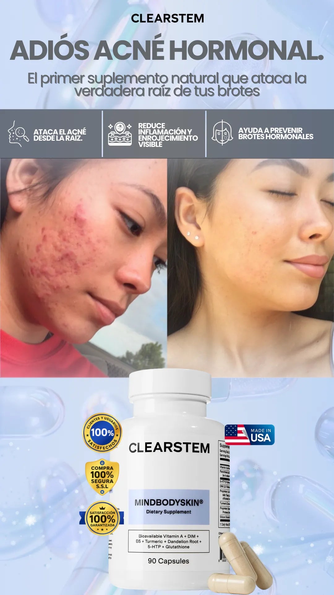 ClearStem | Controla el acné hormonal para una piel limpia