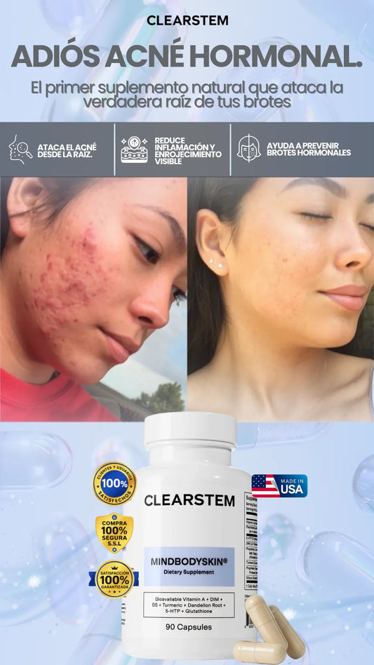 ClearStem | Controla el acné hormonal para una piel limpia