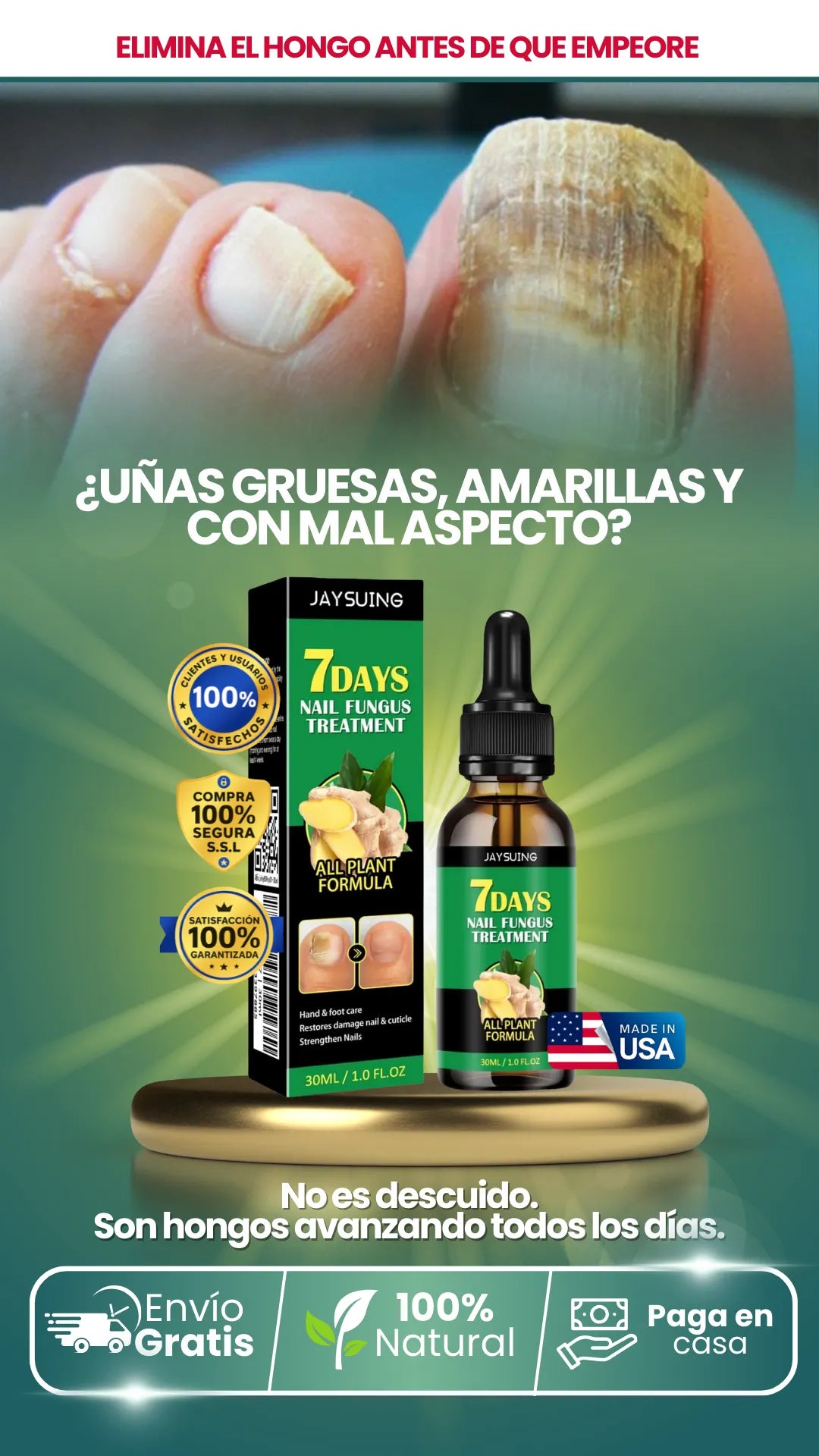 7 Day Nail Fungus | Freno total a la infección por hongos