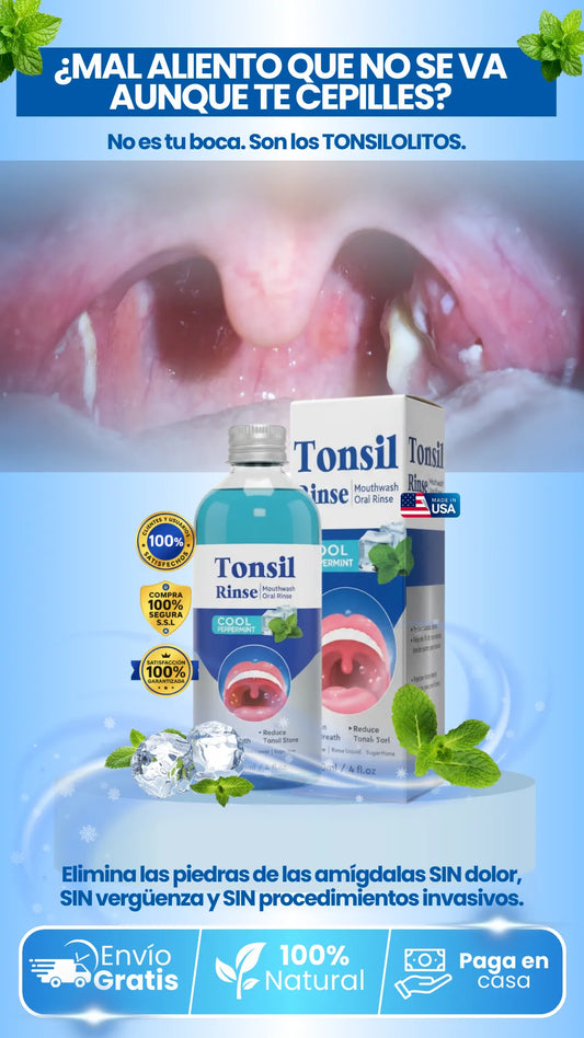 Tonsil Rinse | Enjuague medicado, Elimina los cálculos de las amígdalas sin dolor