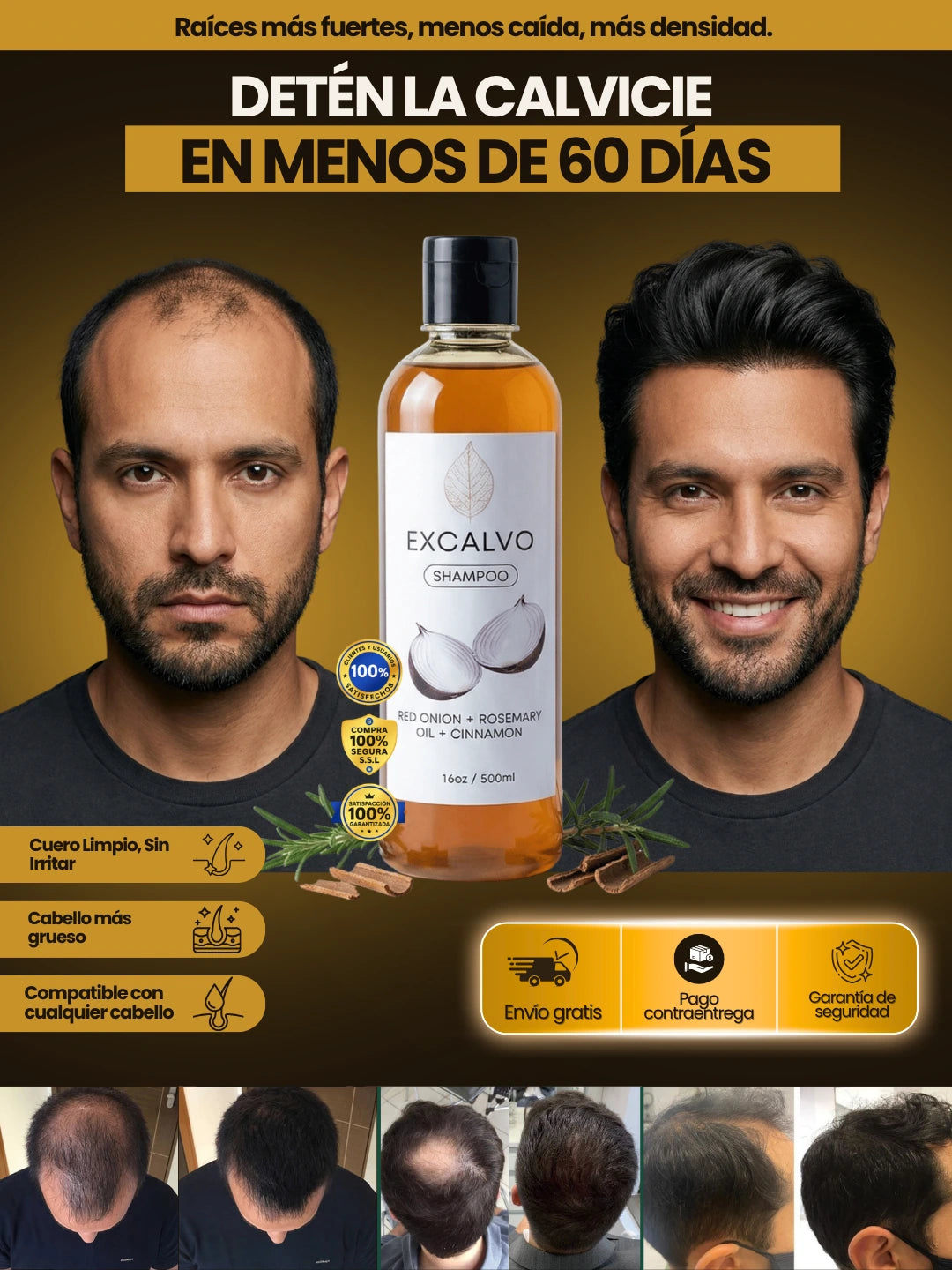 Shampoo Excalvo | Freno total a la calvicie y caída severa