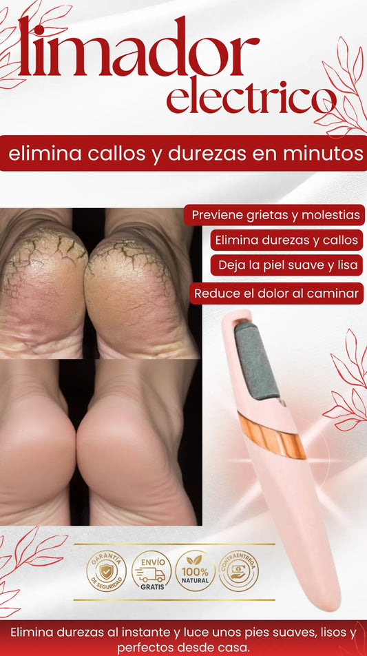 Limador de callos | Elimina callos y luce pies suaves