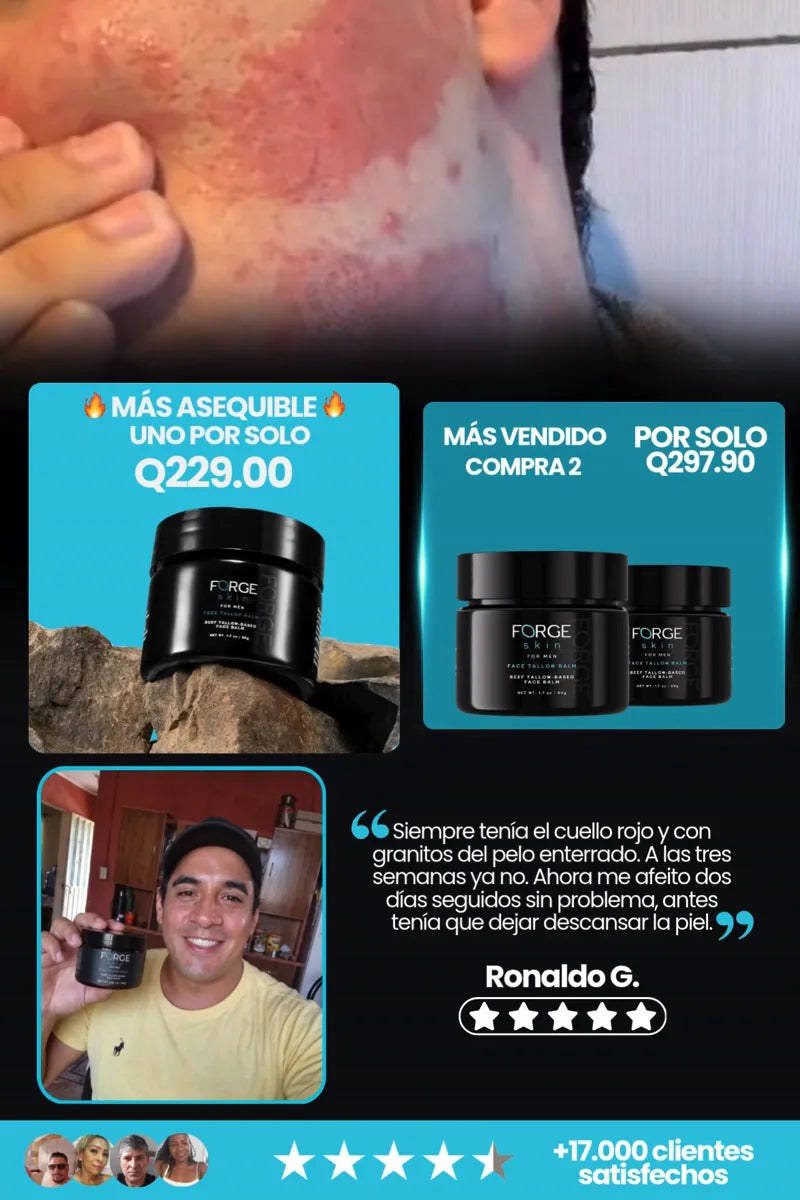 forgeskin-flyer-1.webp