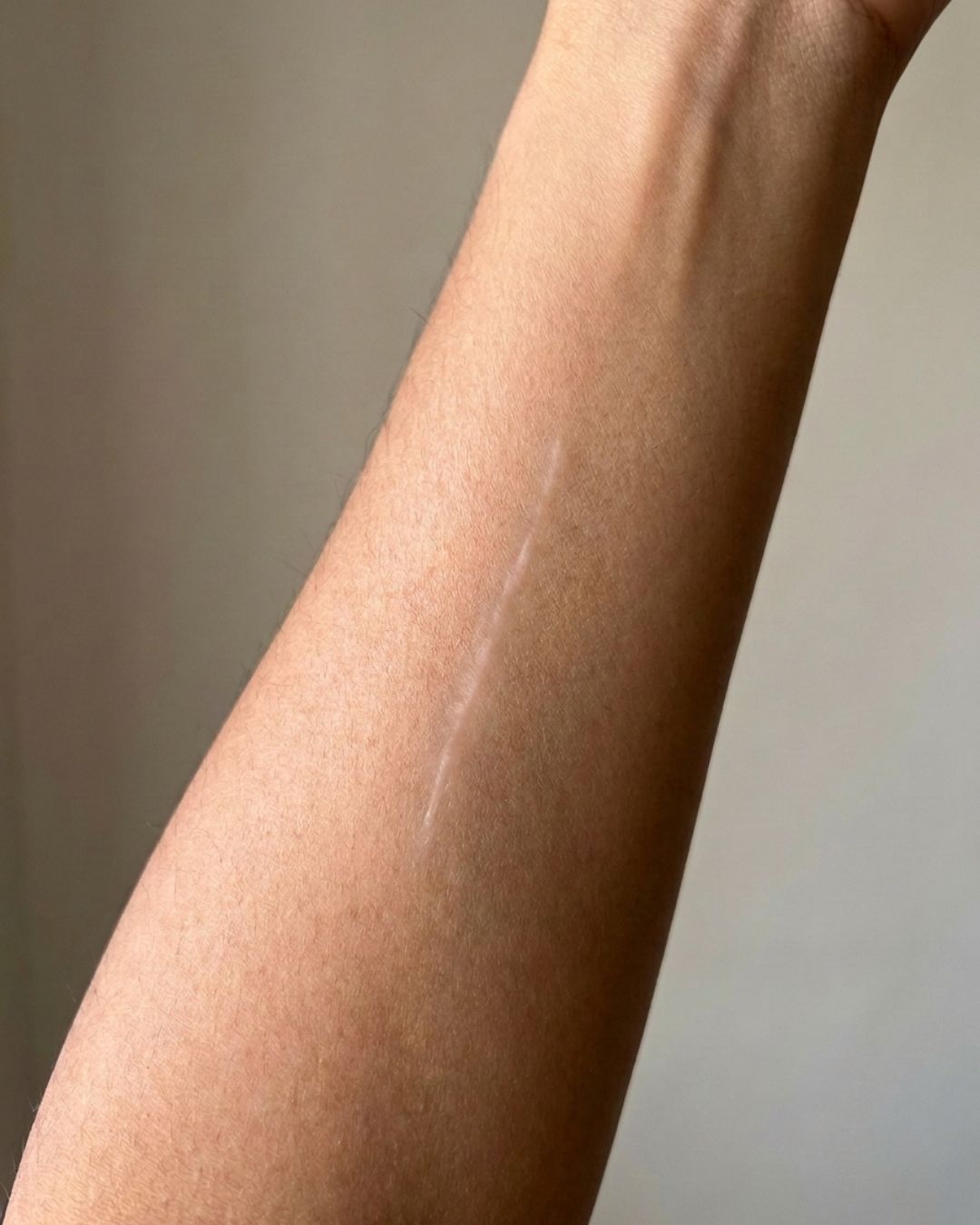 Jaysuing Scar Removal Cream