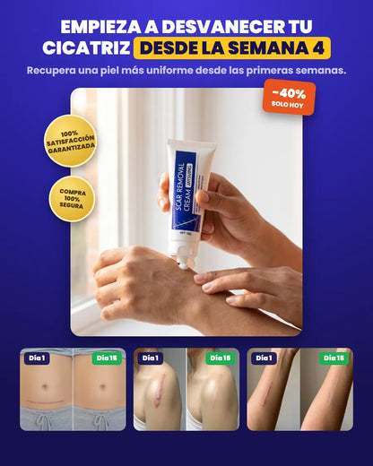 Jaysuing Scar Removal Cream: desvanece tu cicatriz desde la semana 4