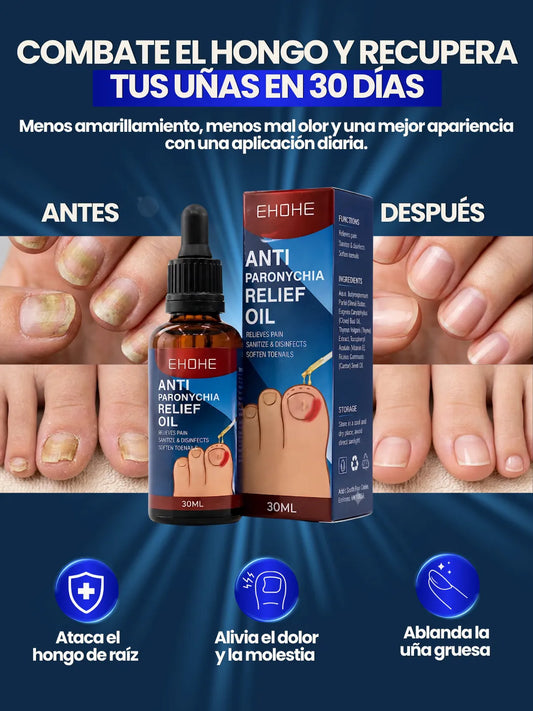 Aceite Eliminador De Hongos en Uñas